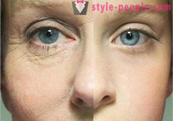 Хепарин мехлем на бръчки под очите: ревюта, характеристики и ефективност приложение