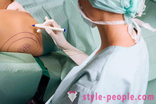 Пластични хирурзи разрушат стереотипите по отношение на тяхната работа