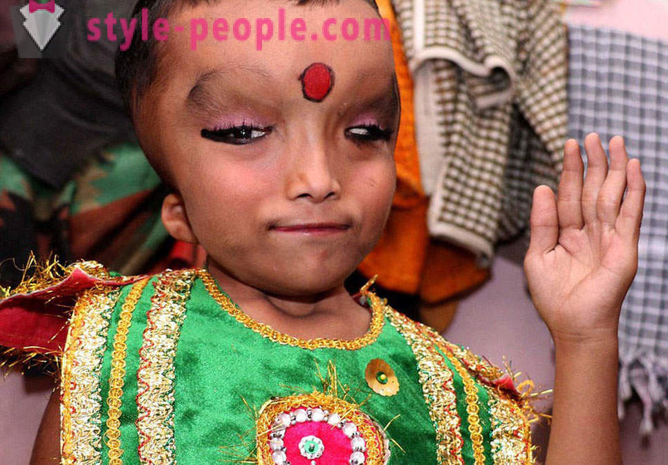 Индийският Селото се поклониха момче с деформиран главата като бог Ганеша