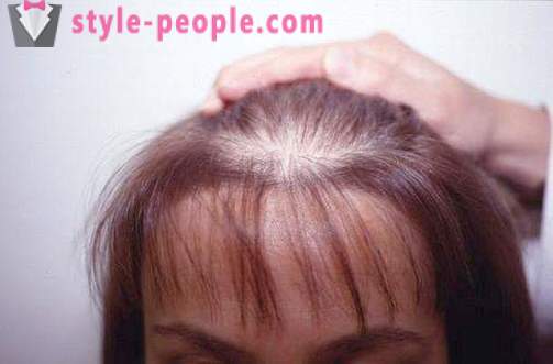 Дарсонвализация коса. darsonvalya Заявление за лечение и превенция на косопад