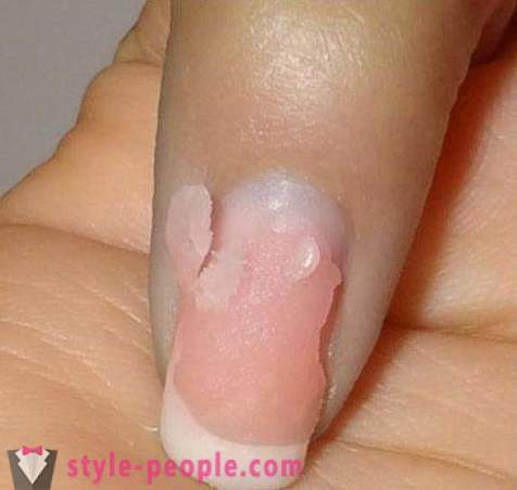 Как да премахнете акрилни нокти у дома? Премахване на акрилни нокти: мнения