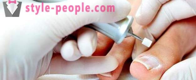 Врастнали нокти на палеца: причини и лечение